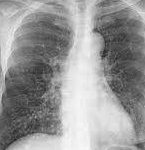 Thumbnail of post image 058
